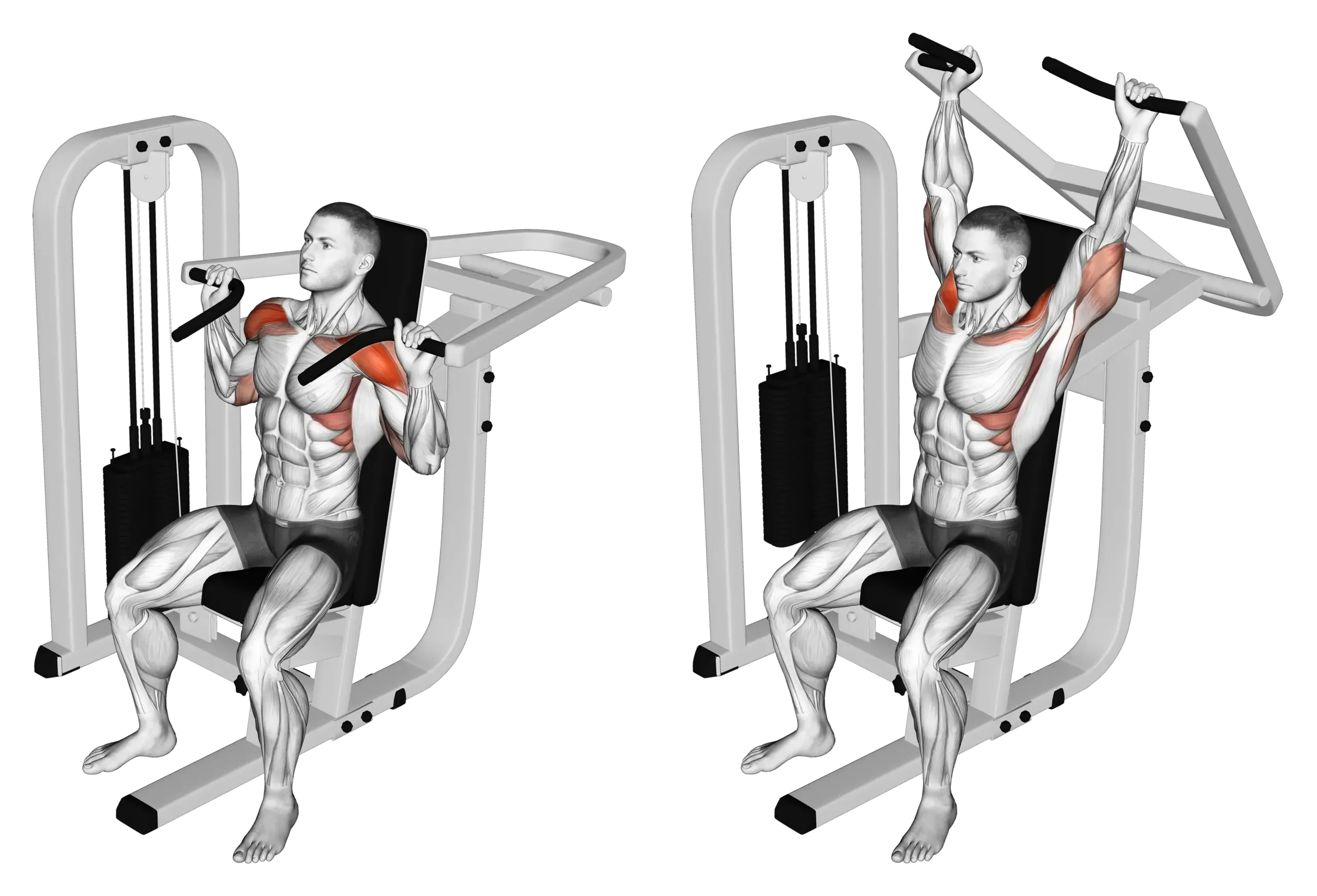 Machine Shoulder Press