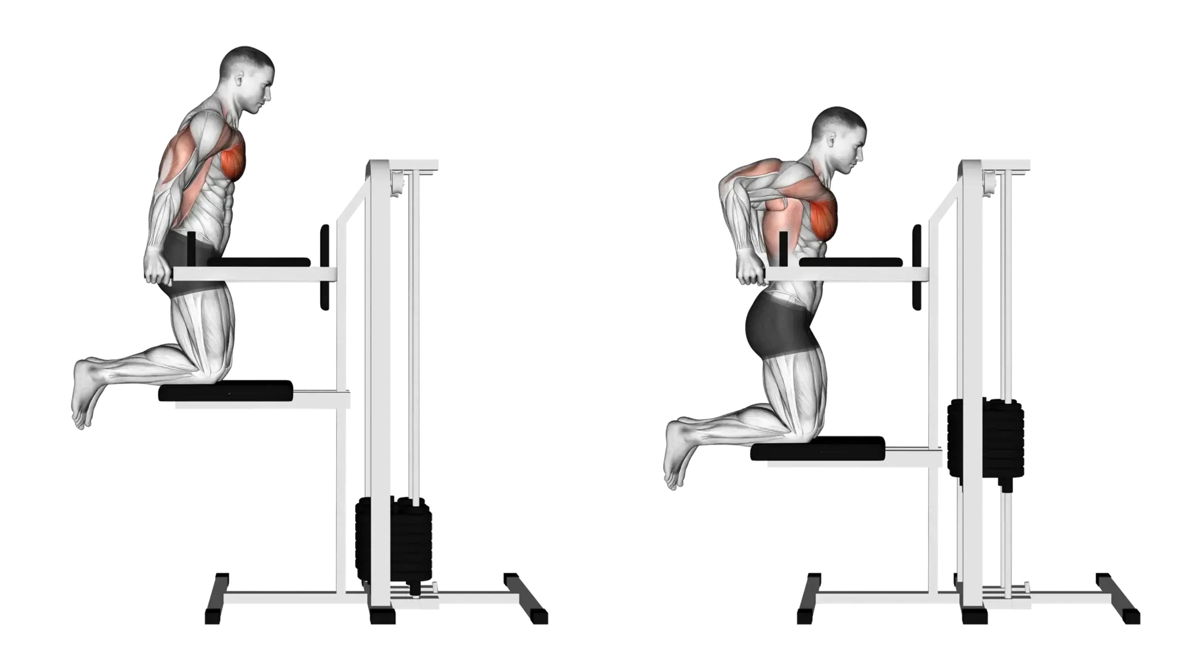 Machine Assisted Chest Dip