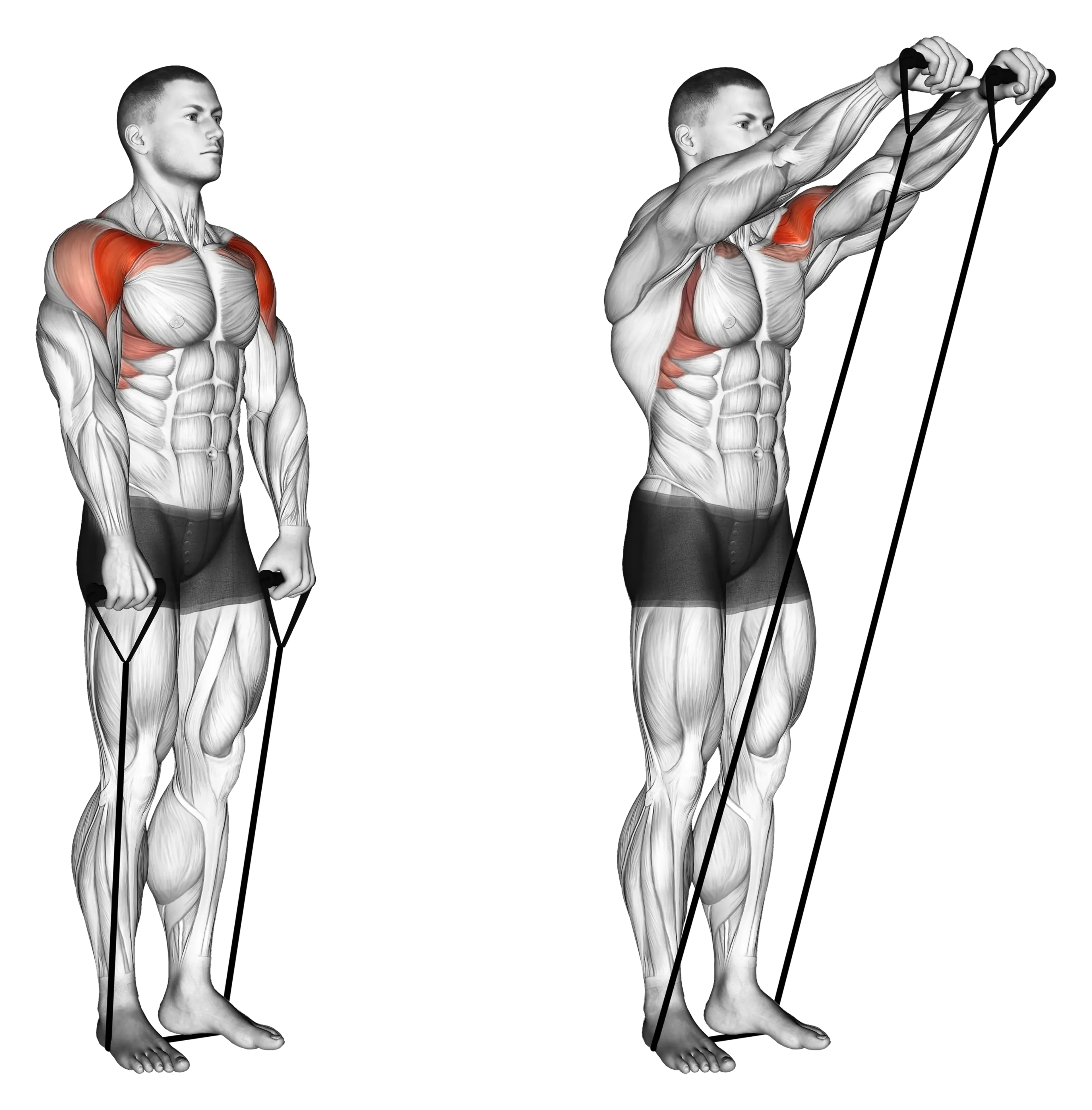 Band Front Raise
